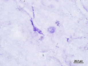 Human Alzheimer Vascular Microglia